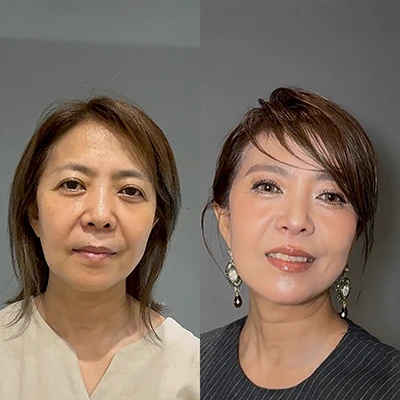 ビフォーアフター