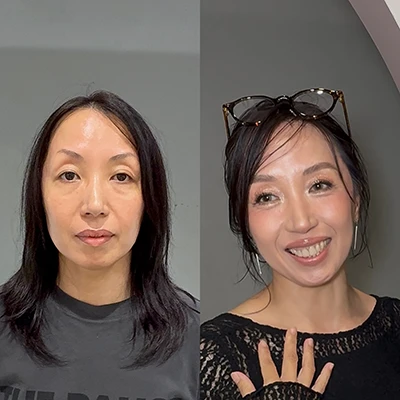 ビフォーアフター