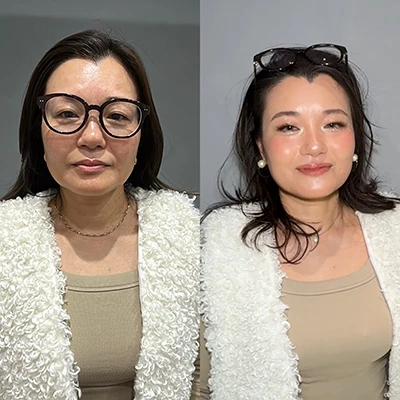 ビフォーアフター