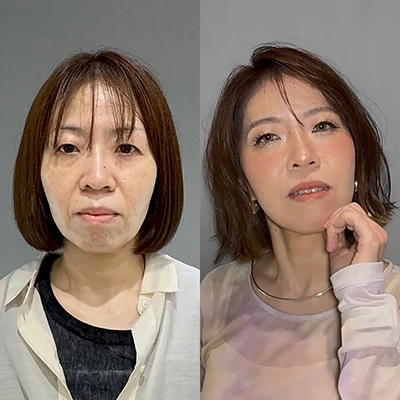 ビフォーアフター