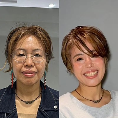 ビフォーアフター