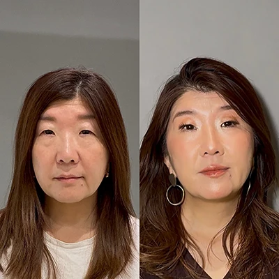 ビフォーアフター