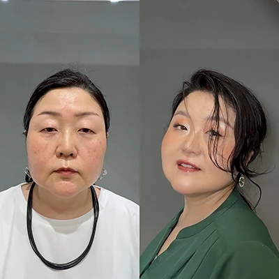 ビフォーアフター