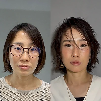 ビフォーアフター